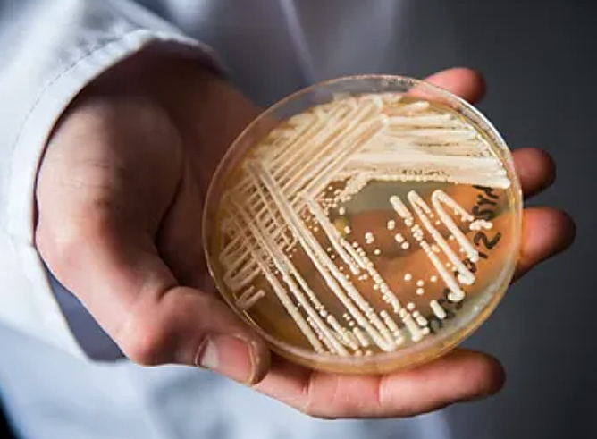 Texas A&amp;M biologist James Smith's outstretched hand holds a petri dish containing a fungal specimen