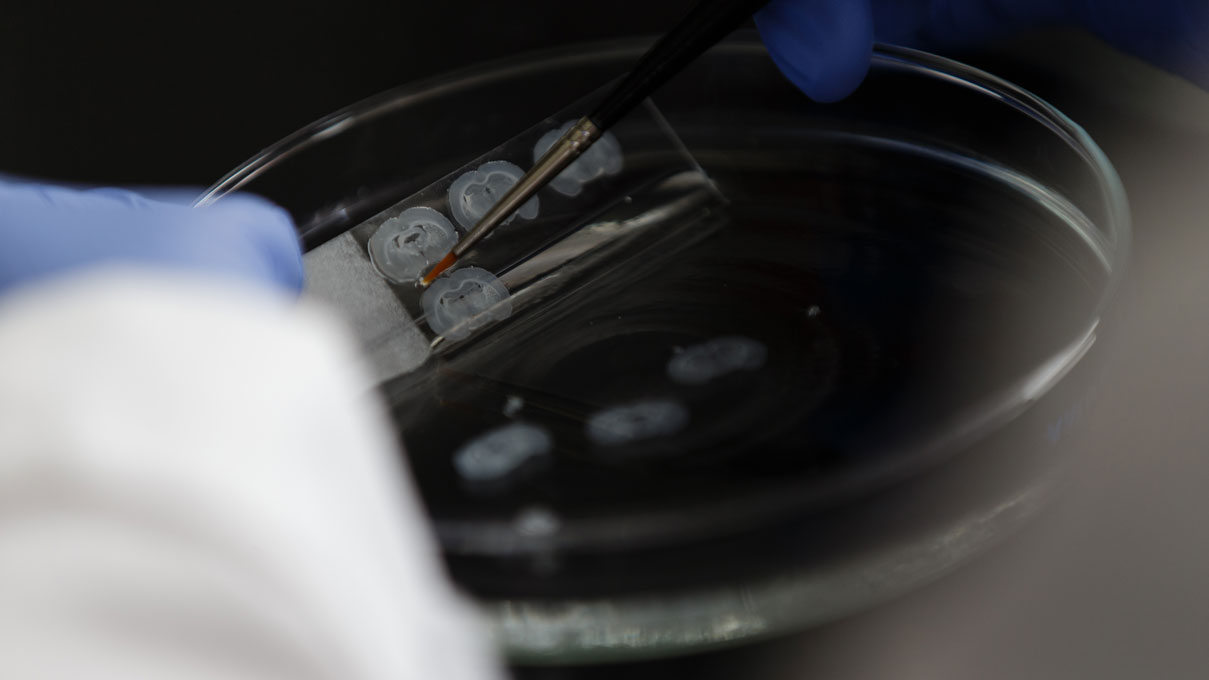 Close up of a slide inside of a petri dish